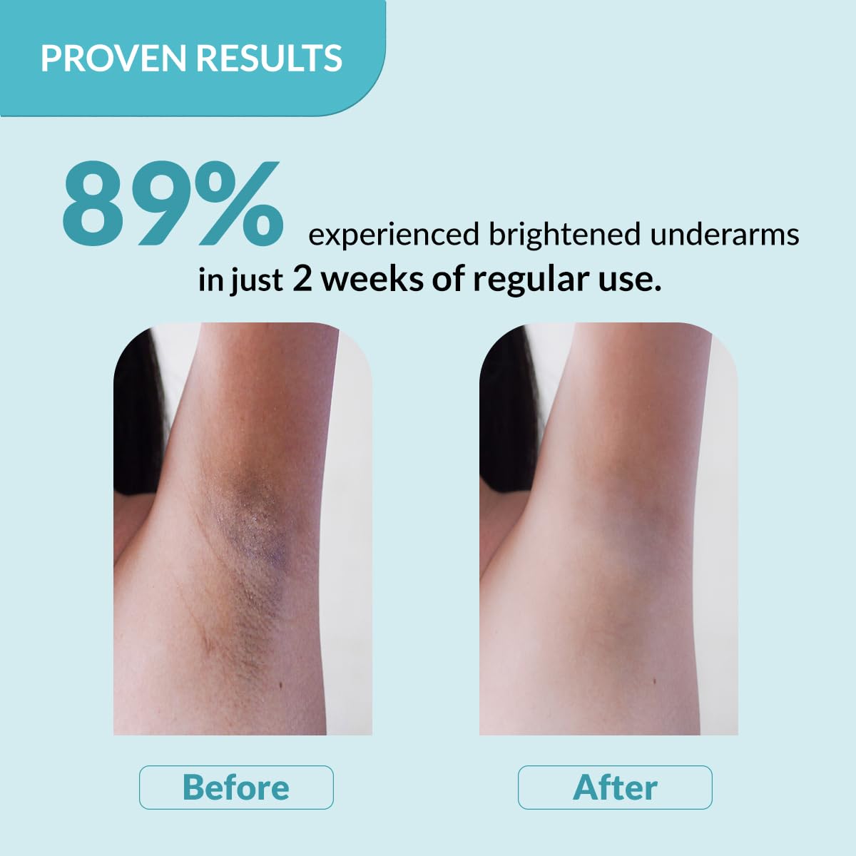 Fixderma Nigrifix Underarm Lightening Roll-On – 60ml